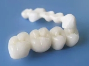 深圳愛爾創全瓷牙幾多錢？全瓷牙邊種好？全瓷牙套型號