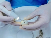 洗牙真嘅會傷害牙釉質麼？一隻鵪鶉蛋打消你洗牙顧慮！