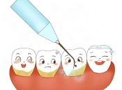 刷牙出血要洗牙嗎？刷牙出血點保養？深圳洗牙幾錢？