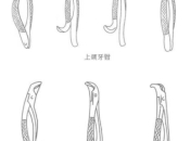 在深圳拔牙用什麼工具及拔牙有哪些適應症？