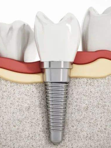 深圳维港口腔连锁