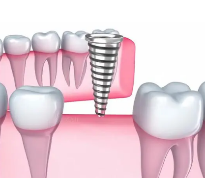 深圳维港口腔连锁