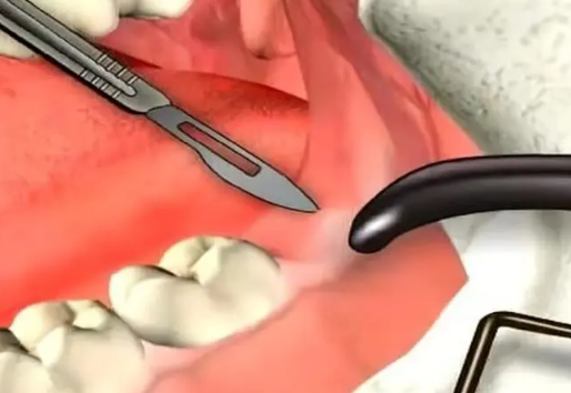 深圳维港口腔连锁