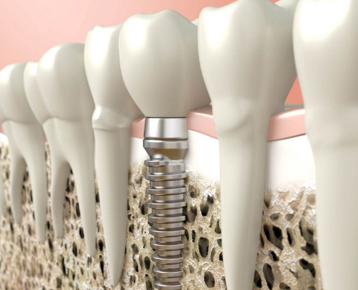 深圳维港口腔连锁