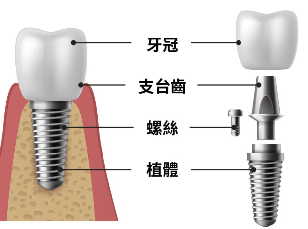 深圳維港口腔
