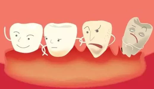 深圳牙周治療