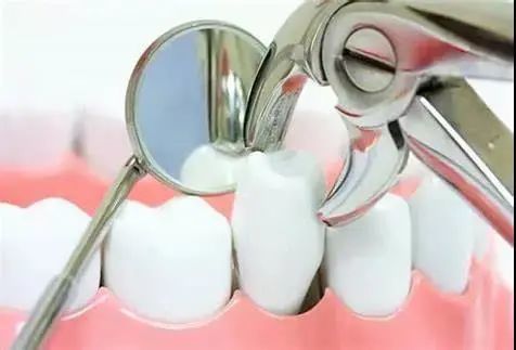 在深圳拔牙可能出現郡些問題呢？