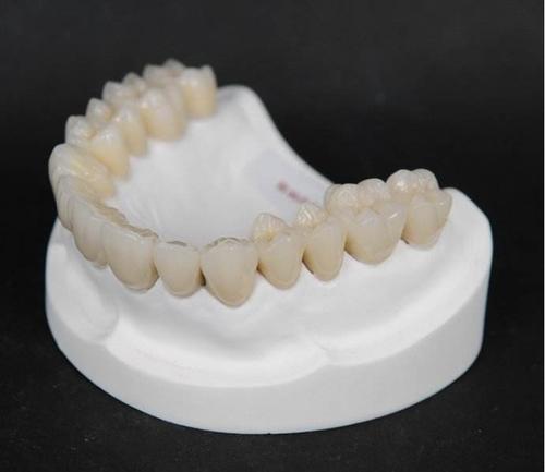 烤瓷牙，用一段時間後會變色嗎？為什麼做烤瓷牙時需要磨真牙？